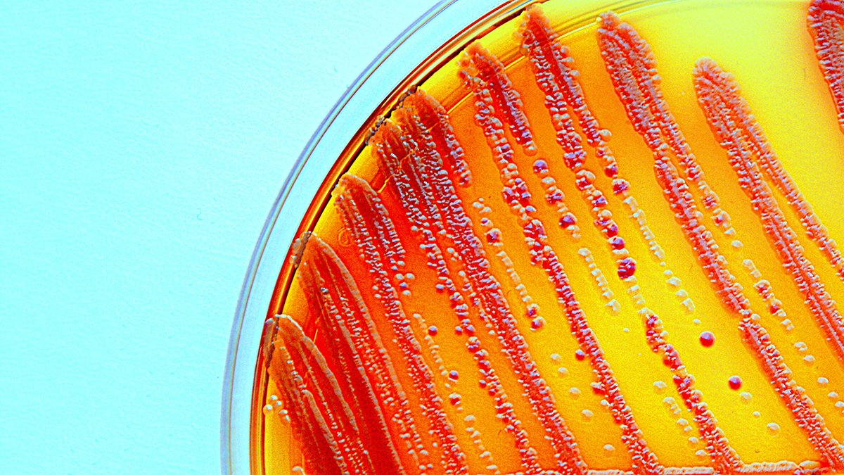 unibern's tweet photo. (1/5) Wie kann die zunehmende #Antibiotikaresistenz bei Patientinnen und Patienten verhindert werden? Dies untersucht unter anderem Adrian Rohrbasser, assoziierter Forscher am #BIHAM der @unibern. https://t.co/SCxL0Mh8Dq @adr_GP https://t.co/1rcLlKp4Kk
