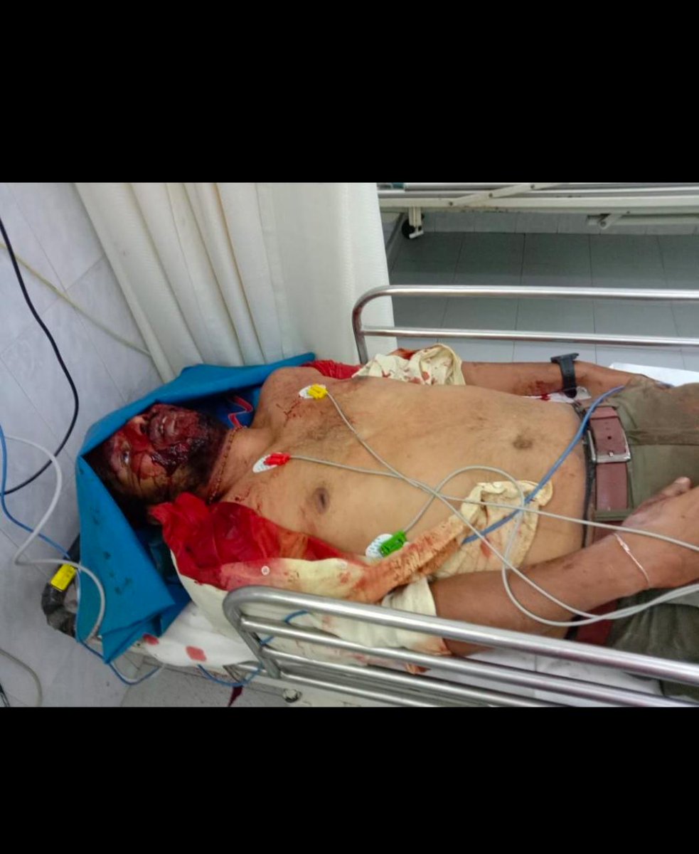 Hindu_Divya's tweet photo. Every yr Hindu activist r brutally murdered in Karnataka
2008 Shashikumar, Ramesh
2011 Vignesh, Sudeendra
2015 Prashant Poojary, Praveen Taj
2016 Rudresh, Raju, Harish
2017 Paresh Mesta
2022 Harsha, Praveen Nettaru
#HindusUnderAttack
#HinduLivesMatters
#PraveenNettaru
#PMModi https://t.co/fTpMGYFPlw