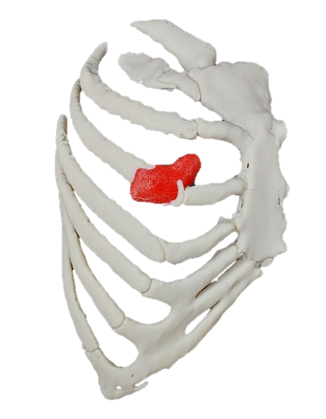 FabLab 3D Hospital Marañón tweet media