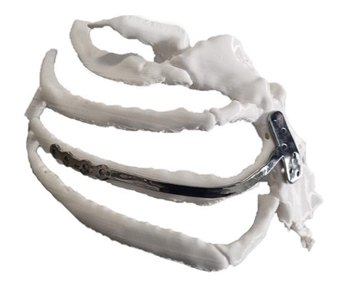 FabLab 3D Hospital Marañón tweet media