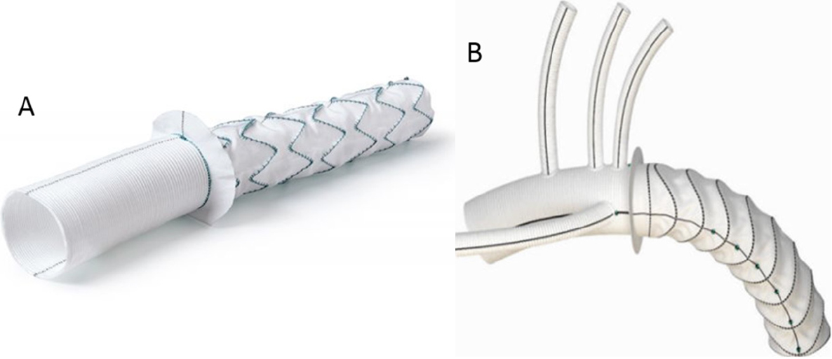 Vessel_Plus's tweet photo. #FET #AcuteAorticDissection
📝Dr. Luca Di Marco and Prof. Davide Pacini et al from Bologna University introduced the #Frozen #elephant #trunk technique and their opinions and recommendations based on their experience started in #2007.👍
📖https://t.co/Jc86Kn3Lfx https://t.co/acnug0nL5y
