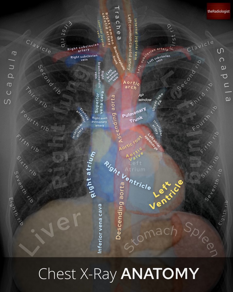 radiologistpage's tweet image. Chest X-Ray anatomy and review areas