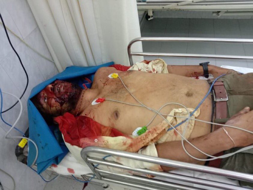 KapilMishra_IND's tweet photo. Kanhaiya lal, Umesh Kolhe , Nishant Rathor, Praveen Nettaru ...

India is under attack

city after city, state after state...

we are losing our sons &amp; brothers 

Time to acknowledge the threat 

We can't keep losing previous and innocent lives one after another https://t.co/rby0Vo7smx