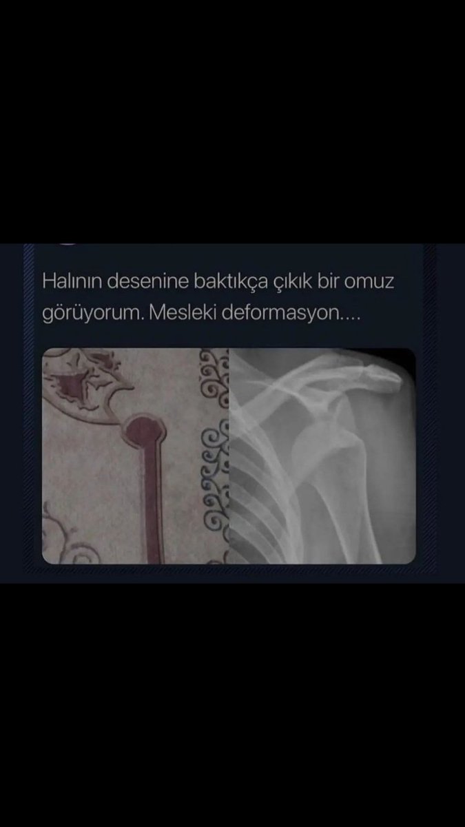 Fizyontolojii's tweet image. 