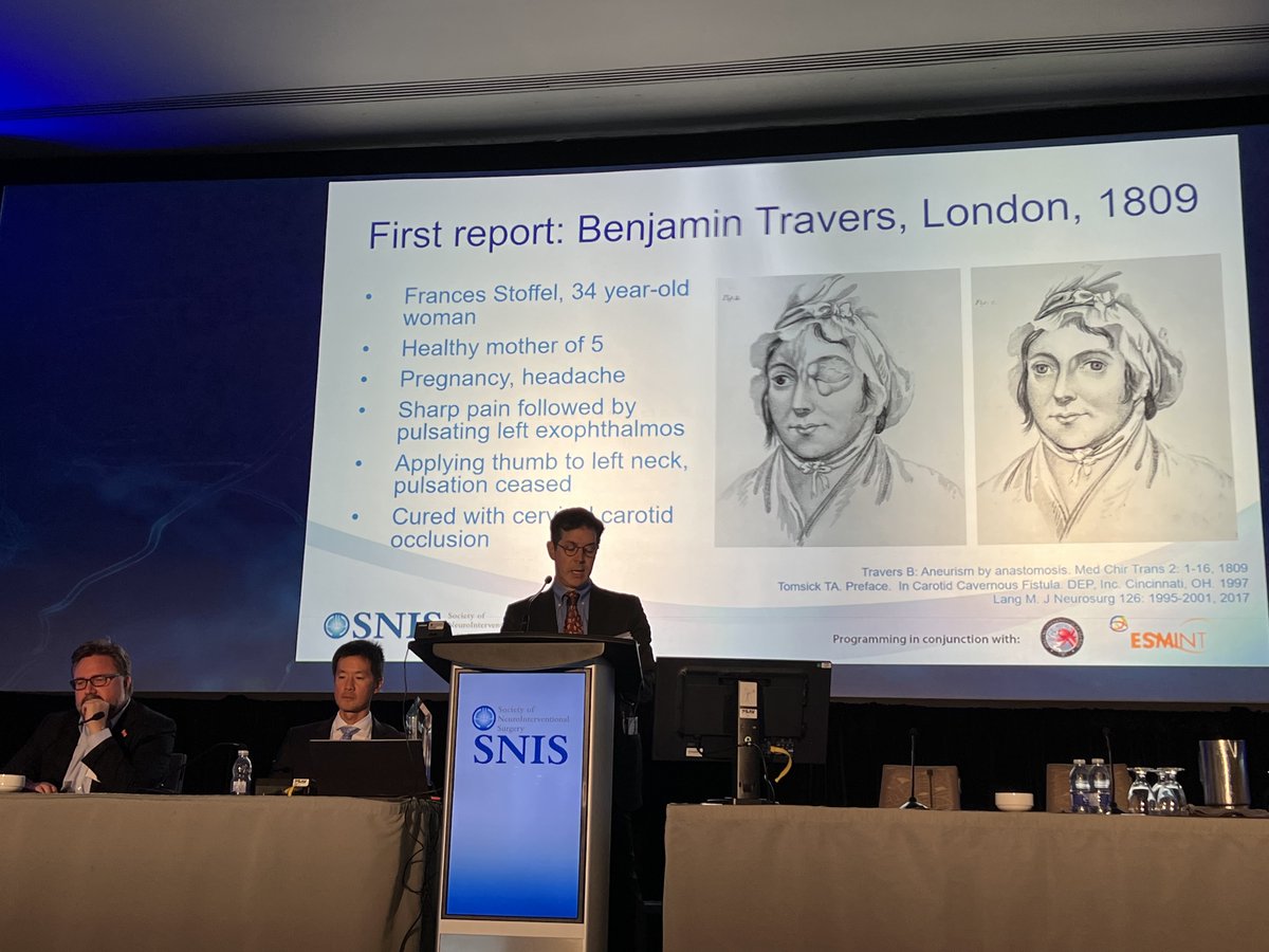 JNIS (@jnis_bmj) on Twitter photo First report of CCF in London, 1809: History of CCF by Philip Meyers, MD
#SNIS2022
<a href="/GuenegoAdrien/">The French Brain Doctor</a> <a href="/lila_sheikhi/">Lila Sheikhi, MD</a> <a href="/DanniDiestro/">Dr. DiestroKE</a> <a href="/JNIS_BMJ/">JNIS</a> <a href="/esmintsociety/">ESMINT Society</a>
<a href="/SNISinfo/">SNIS Info</a> <a href="/fcalbuquerque51/">Felipe C. Albuquerque</a> <a href="/aggiemarie93/">Marie Williams Denslow</a> <a href="/rdeleacymd/">Reade De Leacy MD</a> <a href="/Fie0815/">Jens Fiehler</a> <a href="/ducruetaf/">Andrew Ducruet</a>
<a href="/DrAltschul/">Dorothea Altschul MD FAHA FSVIN</a> <a href="/DrMichaelLevitt/">Michael Levitt, MD</a> First report of CCF in London, 1809: History of CCF by Philip Meyers, MD
#SNIS2022
<a href="/GuenegoAdrien/">The French Brain Doctor</a> <a href="/lila_sheikhi/">Lila Sheikhi, MD</a> <a href="/DanniDiestro/">Dr. DiestroKE</a> <a href="/JNIS_BMJ/">JNIS</a> <a href="/esmintsociety/">ESMINT Society</a>
<a href="/SNISinfo/">SNIS Info</a> <a href="/fcalbuquerque51/">Felipe C. Albuquerque</a> <a href="/aggiemarie93/">Marie Williams Denslow</a> <a href="/rdeleacymd/">Reade De Leacy MD</a> <a href="/Fie0815/">Jens Fiehler</a> <a href="/ducruetaf/">Andrew Ducruet</a>
<a href="/DrAltschul/">Dorothea Altschul MD FAHA FSVIN</a> <a href="/DrMichaelLevitt/">Michael Levitt, MD</a>
