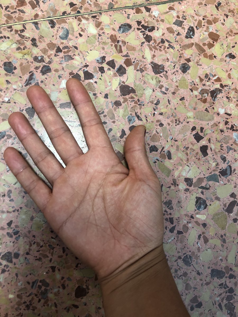 Para los que tengan #mascotas 

Antes de sacarla a pasear...

➡ ¿Conoces la regla de los 5⃣ segundos? 

👉Pon el reverso de tu mano en el suelo y si no eres capaz de soportar el #calor 5 segundos, tu perro 🐶 tampoco lo hará

#WeloveAnimal