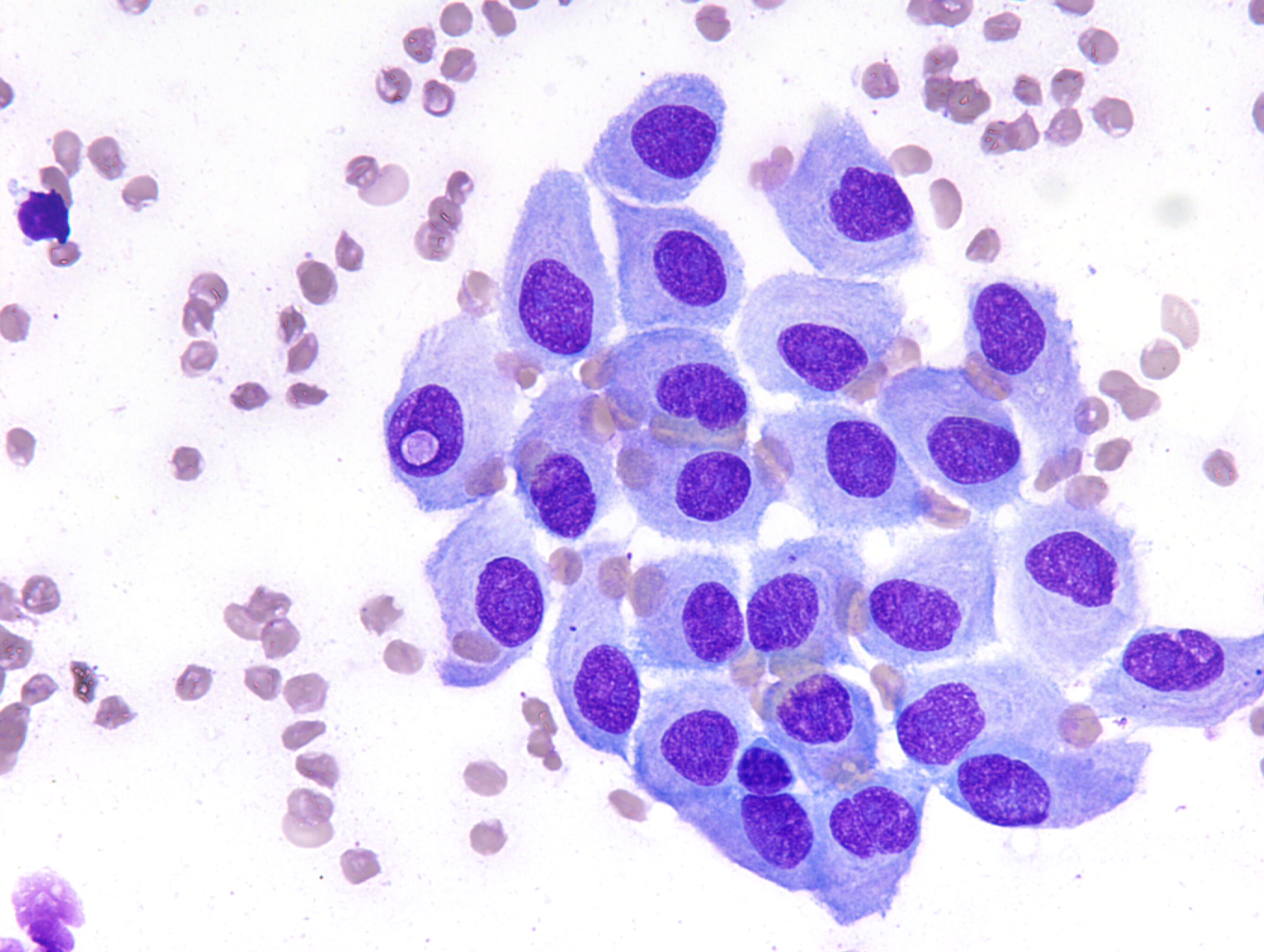 Mesothelial cells
