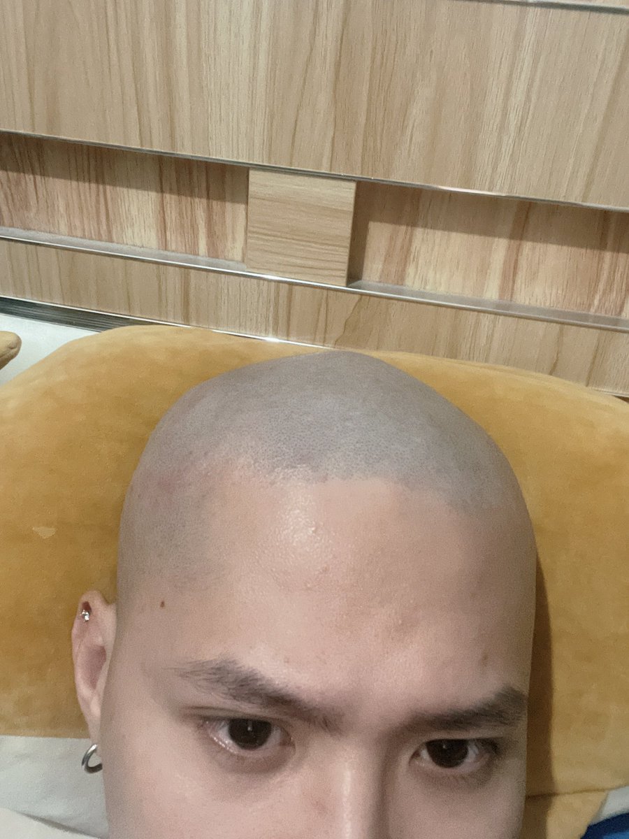 夏天必备
#光头 #寸头 #剃头 #光头犬