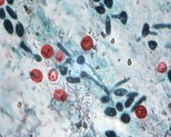 enn_nafnlaus's tweet photo. @28delayslater My current crypto holdings:
- #cryptoclidus
- #cryptosporidium
- #cryptomeria
- #cryptopine

Considering:
- #cryptolite
- #cryptozoology 
- #cryptococcosis https://t.co/jesNHUbUKw