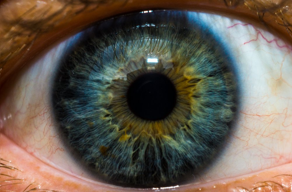 Web: …hthalmology.peersalleyconferences.com
A single injection reverses blindness in patient with rare genetic disorder #Scleritis #Uveitis #Inflammation #OcularOncology #pathology #biochemistry #VitreousDisorders #lensdisorder #retina #cellbiology #Immunology #pathophysiology #ophthalmology