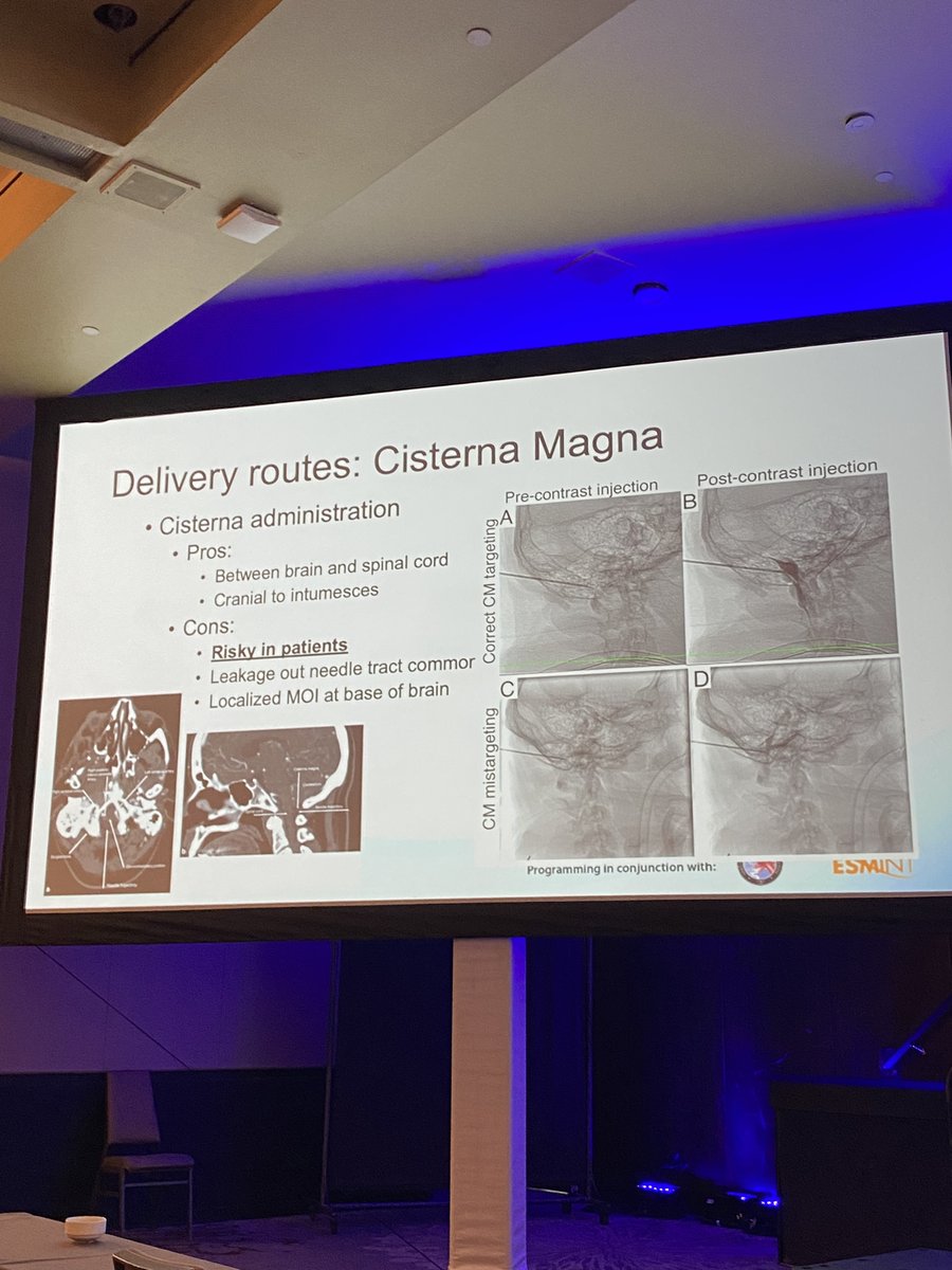 JNIS_BMJ's tweet photo. Dr Heather Gray-Edwards on drug delivery to the CNS: AAV-GM2 delivery #taysachs #sandhoff
#SNIS2022
@GuenegoAdrien @lila_sheikhi @DanniDiestro @JNIS_BMJ @SNISinfo @fcalbuquerque51 @rdeleacymd @ducruetaf @DrAltschul
@DrMichaelLevitt
@thepaulsingh @mattgounis @AjitSPuri1 https://t.co/7sFG7ZvNmo
