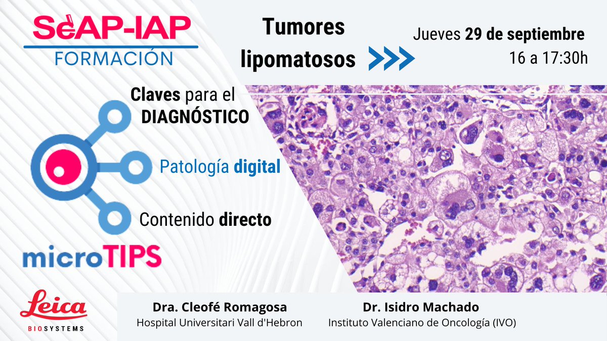 El jueves 29/9 de 16:00 a 17:30h será nuestro #microTIPS de la <a href="/SEAP_IAP/">SEAP-IAP</a> sobre Tumores lipomatosos a cargo de la Dra. <a href="/CleoRomagosa/">Cleo Romagosa</a> (Hospital Universitari Vall d'Hebron) y el Dr. <a href="/MachadoIsidrin/">Isidro Machado MDPhD</a> (Instituto Valenciano de Oncología, IVO) ¡No te lo pierdas! seap.es/microtips