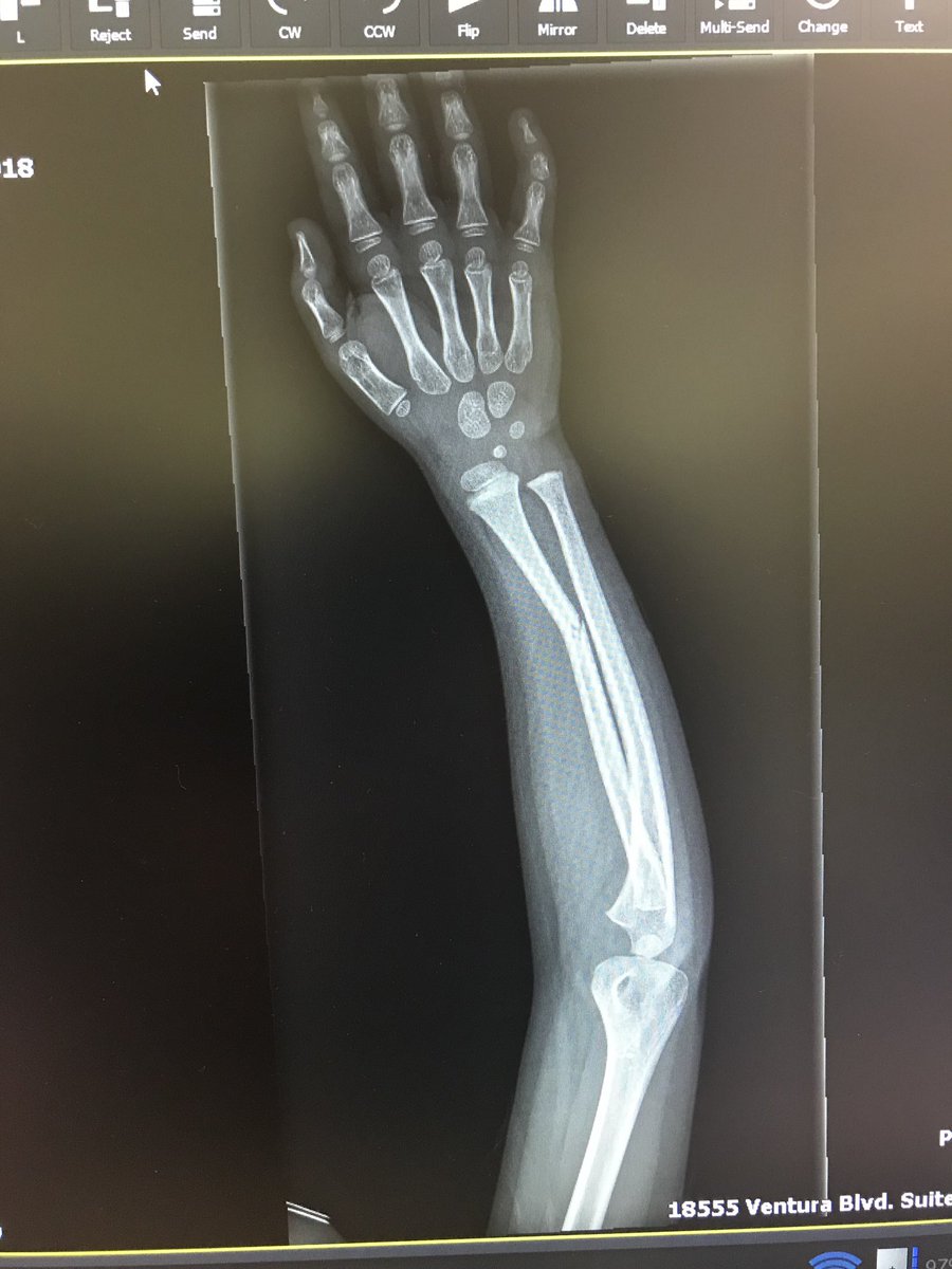 TheSharpDavid's tweet image. “Well, that was a nice trip!”
-Porter, upon returning home from hospital