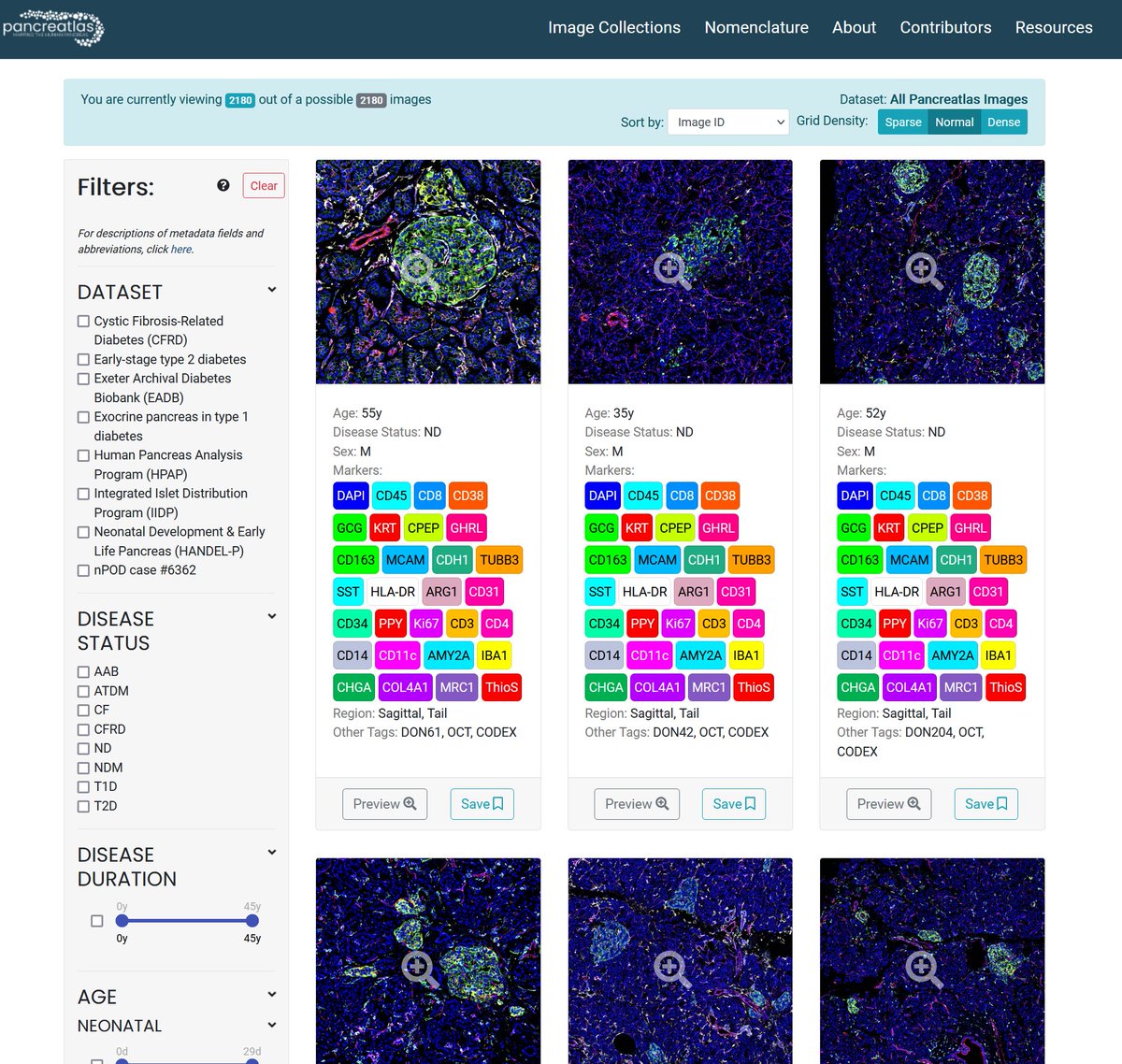 Pancreatlas tweet media