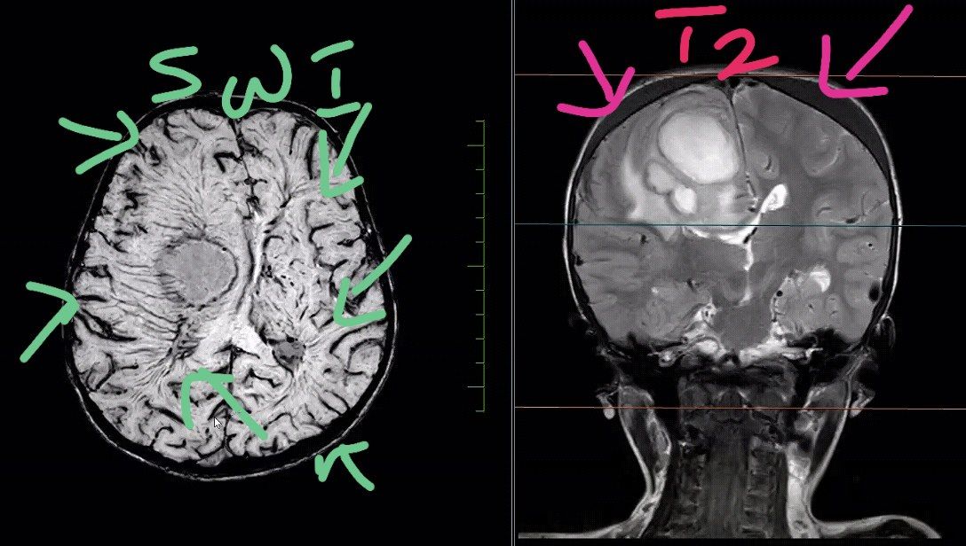 Rajesh S on Twitter: 