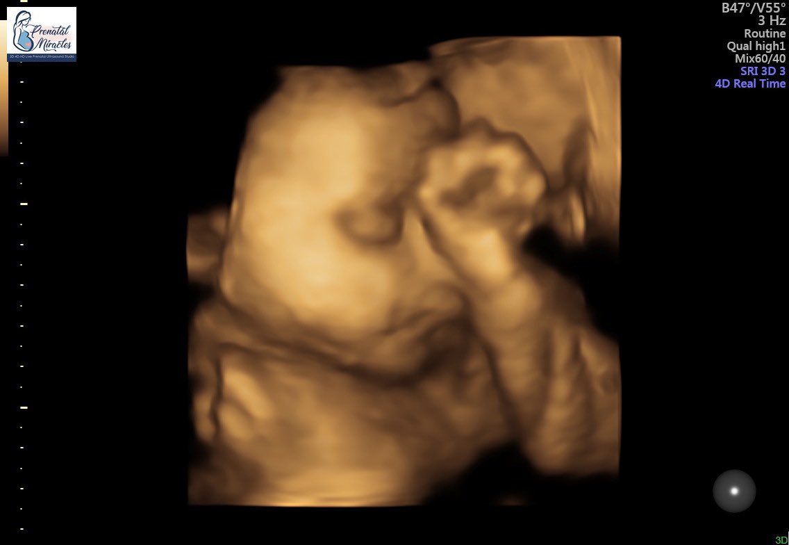bryynahh's tweet photo. Happy 30 weeks baby girl ❤️ https://t.co/6UPLRm8qfK
