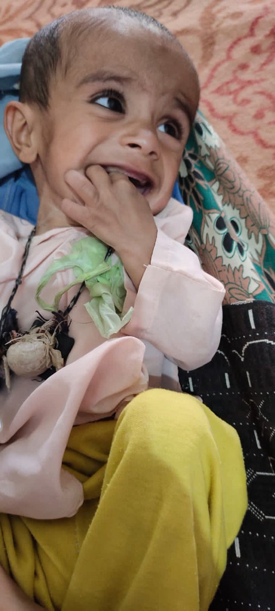BRSP_Pakistan's tweet photo. Diarrhea causes 16% of all child deaths in Pakistan, However, only 32.9% of children suffering from diarrhea are treated with LO-ORS, and a mere 5% receive zinc. Awareness-raising around exclusive breastfeeding and dietary practices can reduce diarrheal episodes significantly. https://t.co/21JggUxPL0