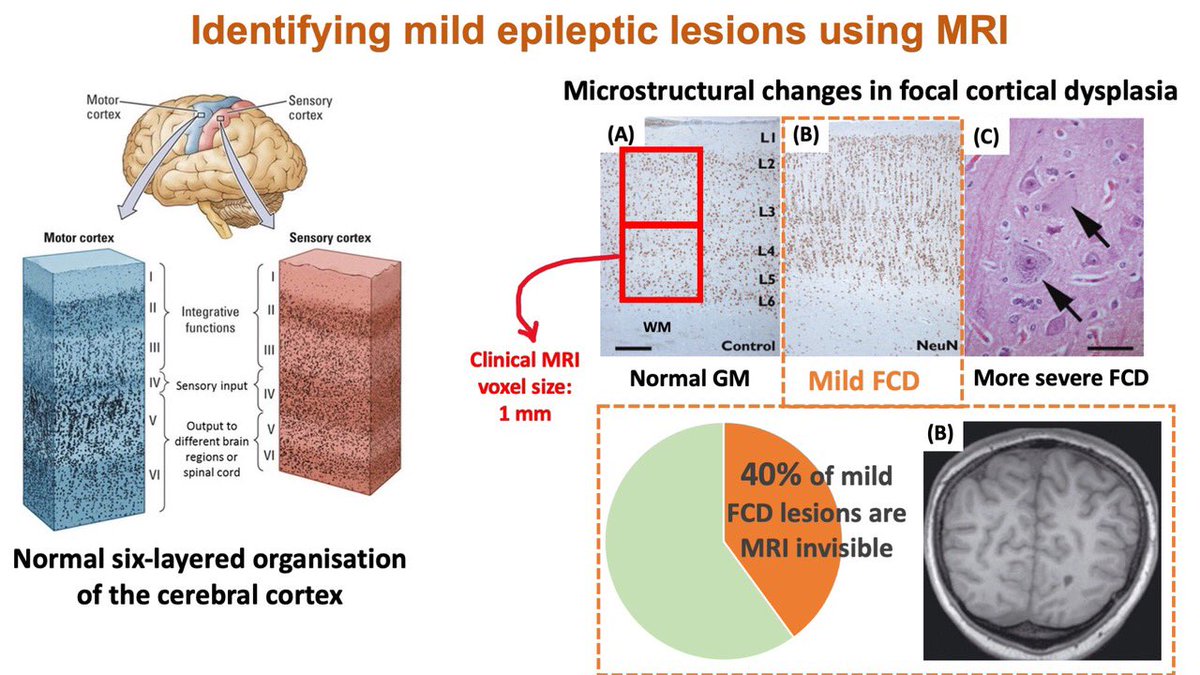 A great pleasure to present part of our research <a href="/CibitIttc/">CIBIT-ITTC</a> <a href="/UQ_CAI/">UQ Centre for Advanced Imaging</a> to these young smart students at the Brain Bee, Meet the Scientist event. We enjoyed discussing the similarity between my cortical laminar microstructure research &amp; Rachael’s English trifle story (FRIENDS 📺)🧠🍰