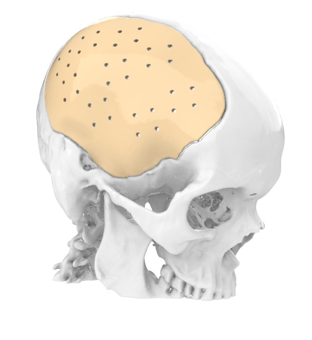 FabLab 3D Hospital Marañón tweet media