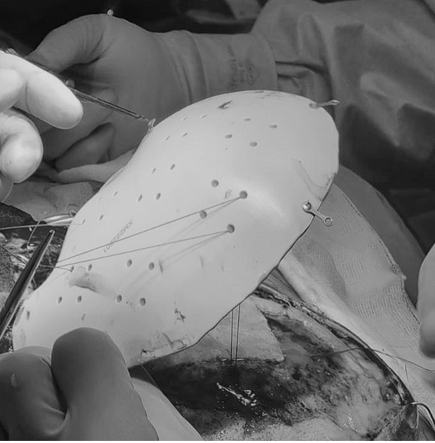 FabLab 3D Hospital Marañón tweet media