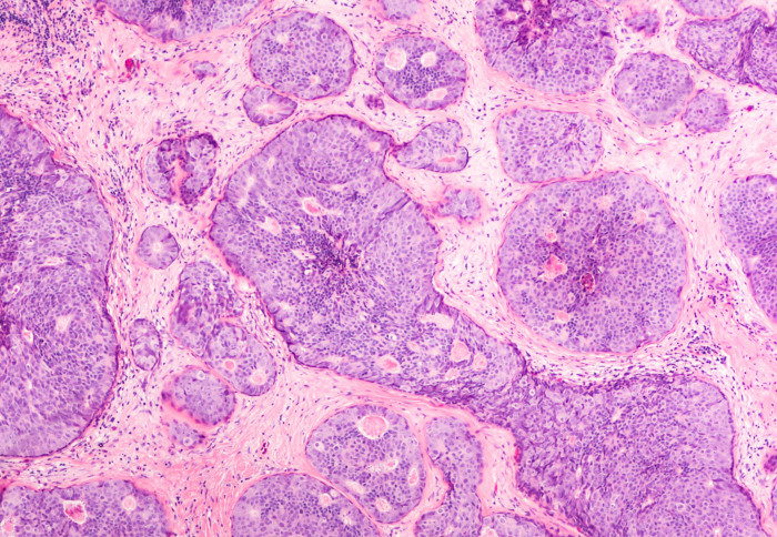 Changing the order of treatments given to #BreastCancer patients could reduce side effects and improve outcomes, according to a new study co-led by S&amp;C's @DanielRLeff <a href="/1LondonBreast/">Paul Thiruchelvam 🇺🇦</a> 

imperial.ac.uk/news/238612/sw…