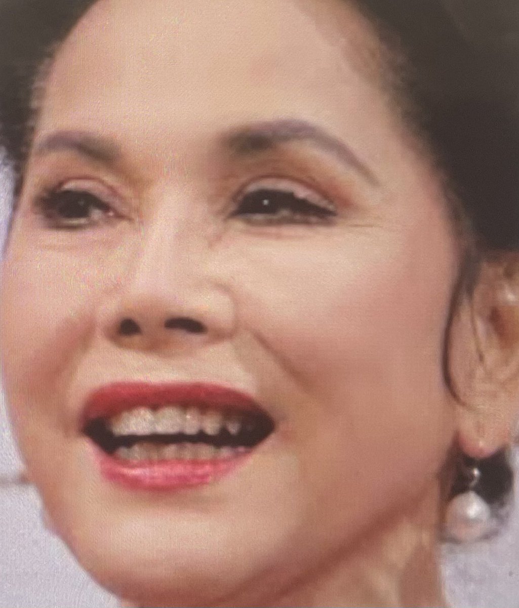 デヴィ 夫人 入れ歯