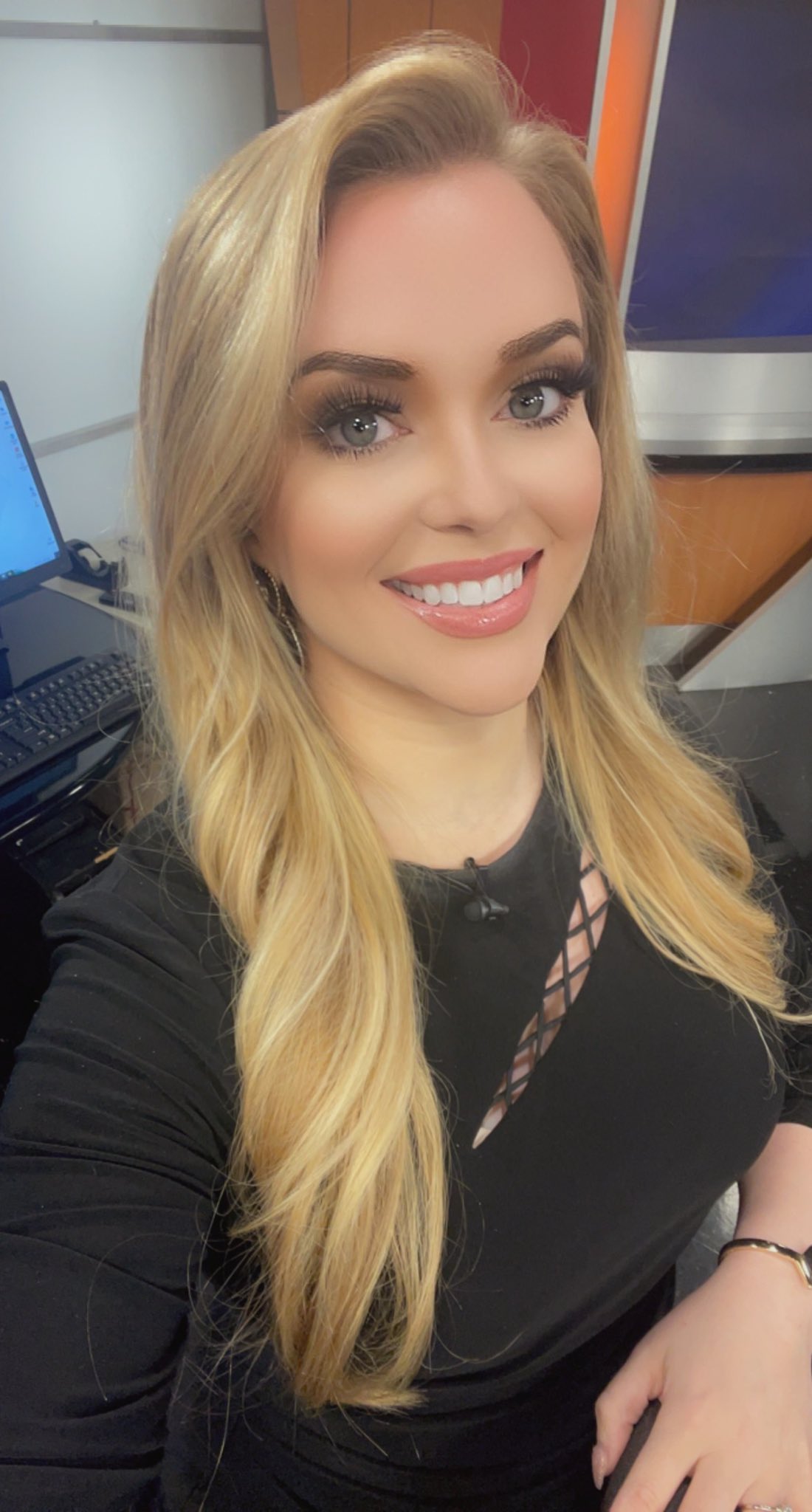 Chelsea Chandler on Twitter "Coated in burn cream thanks to second degree burns and generally