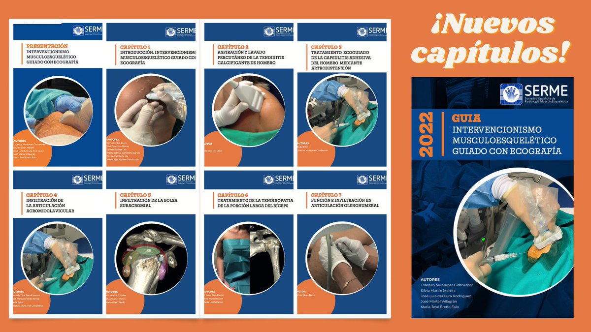 🥳Nuevos capítulos 📢

💉💪🏼💉💪🏼💉💪🏼💉💪🏼💉💪🏼💉💪🏼Guía #SERME
de intervencionismo MSK
💉💪🏼💉💪🏼💉💪🏼💉💪🏼💉💪🏼💉💪🏼

#iRad #MSKRad #Radiology  
visita nuestra web
👇🏼
serme.es/guia-serme-de-…