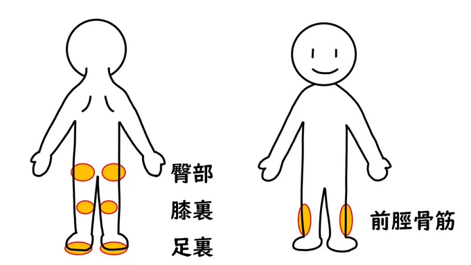 ふくらはぎしかほぐさないんですか?とよく聞かれます。答えはNOです。ふくらはぎをほぐすには、イラストの4つの筋肉もほぐさないといけません。よく驚かれるのが臀部ですここをほぐすとそんなところコッてるんだと驚かれます臀部大事ですちなみに肩コリも臀部をほぐせと教わります 