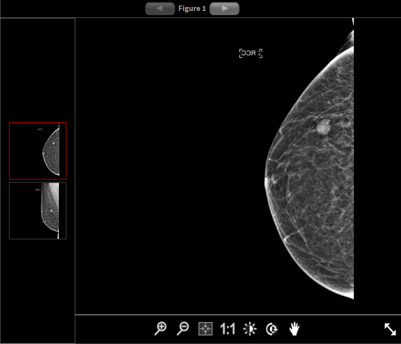 The RFS Case of the Month not only helps trainees to become more familiar with important breast pathologies, it's a great way for them to work closely with mentors, delve into a particular etiology, & gain experience generating scholarly works. Learn more: bit.ly/3zyuEZc