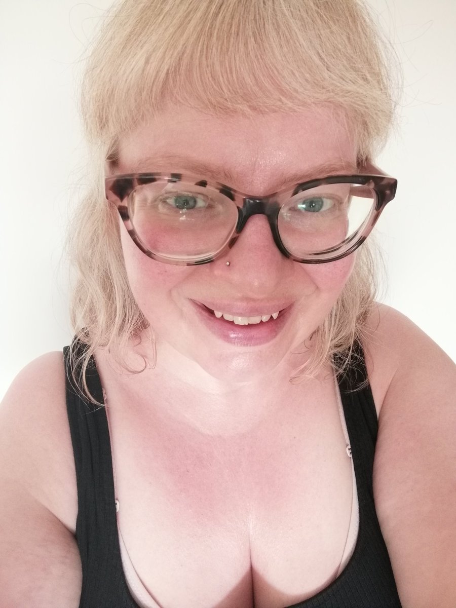 Unpreparedadult's tweet photo. #gingertan https://t.co/50THYo42Pt