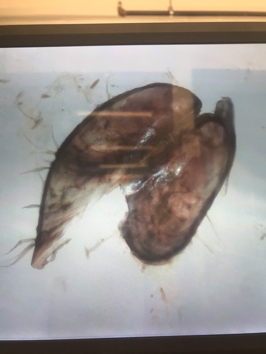leahcorckran's tweet photo. What’s in a Hemigrapsus sanguineus’s cardiac stomach? Mussels and arthropods and algae (oh my!) https://t.co/KR3EtYdpO0