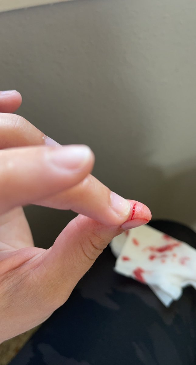 I thought it needed amputated, but super glue saved it #appleslicer