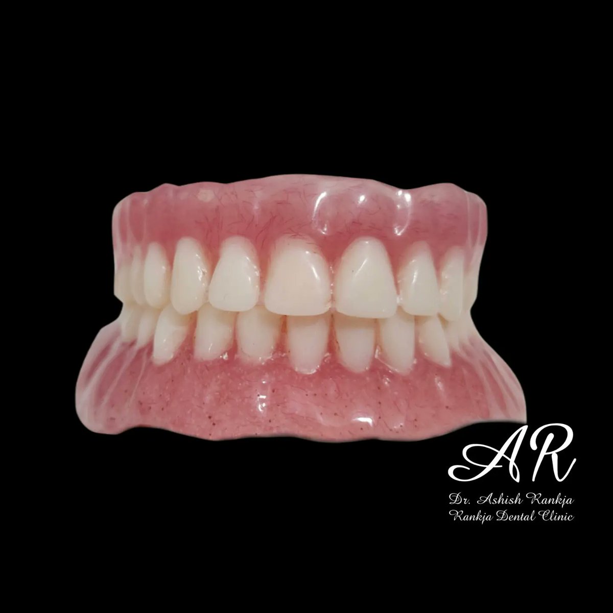 Ashish_Rankja's tweet photo. #dentures #dental #dentistry #dentist #teeth #smile #dentalimplants #teethwhitening #dentallab #denture #dentalart #dentallaboratory #smilemakeover #dentista #dentistryworld #dentalcare #dentalphotography #dentalstudent #dentalassistant #completedentures
@Ashish_Rankja https://t.co/tUYfnFD9r6