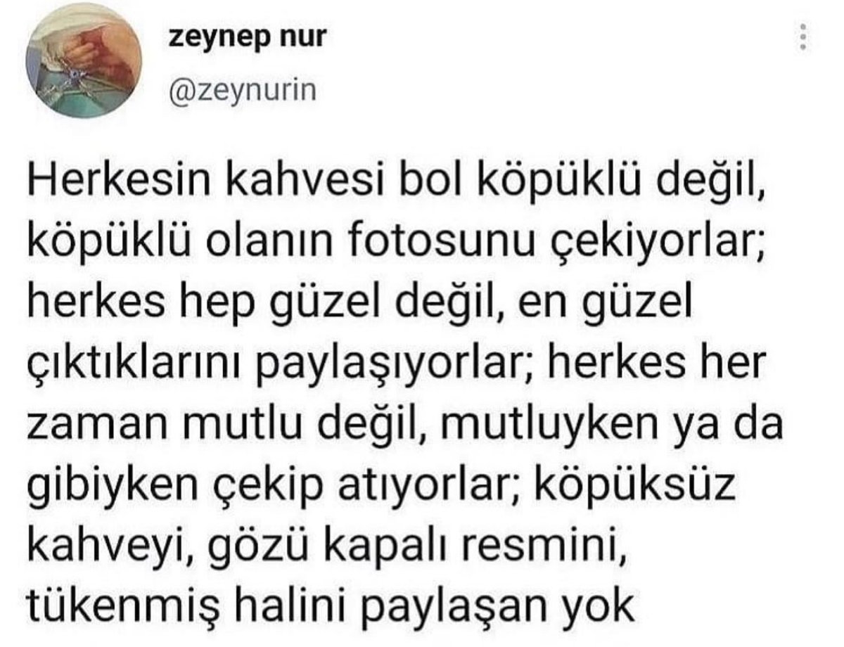 Alnı Öpülesi Tivitler (@alniopulesitivt) on Twitter photo 