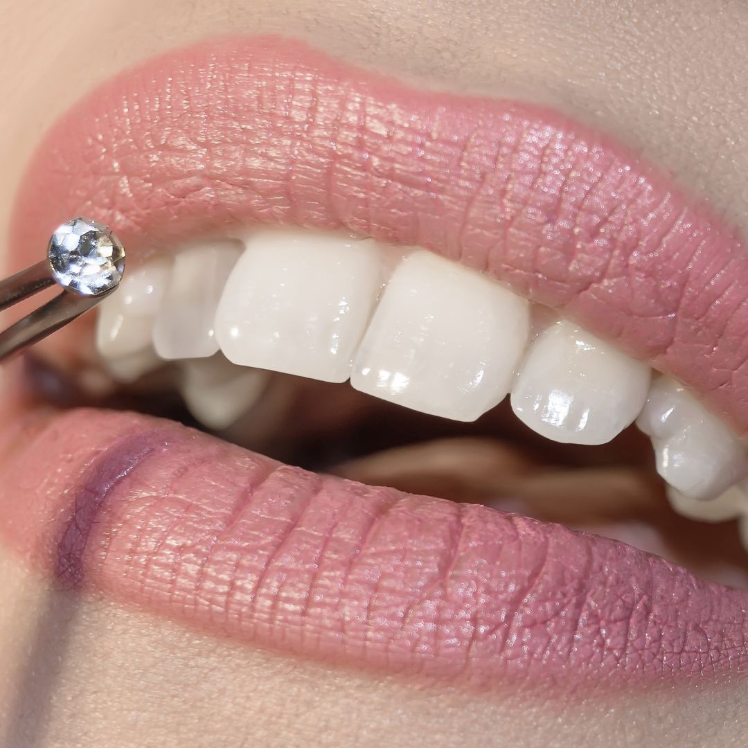 💎 Are you insured for Tooth Jewels?

As tooth jewels become more and more popular, the big question from our clients is "Are we covered?"

# beautyinsurance #saloninsurance #insurancebrokeraustralia #beautysaloninsurance #toothjewels

📱 (07) 5502 8326
🖥 sparrowinsurance.com.au
