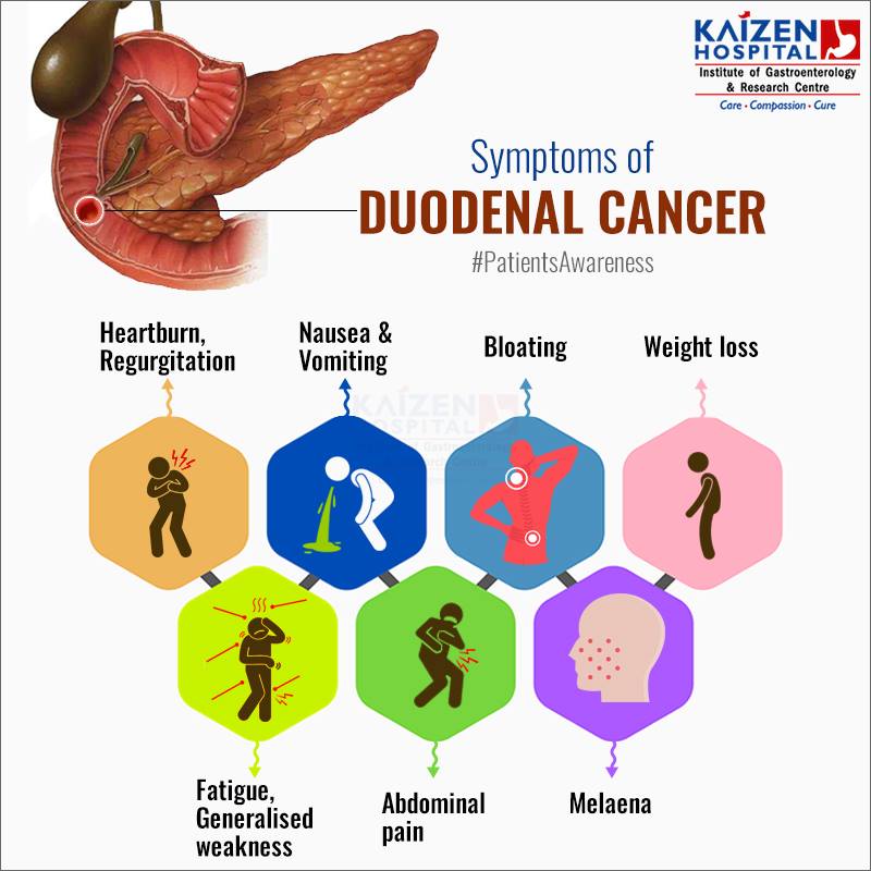 Chemotherapy and Immunotherapy infusions Today! Instead of posting a pic of my ugly mug I want to spread awareness for duodenal cancer. Push the issue with Dr.
Please visit and share the go fund me page at gofund.me/1d1efb71 Even a small $10 donation makes a huge difference!