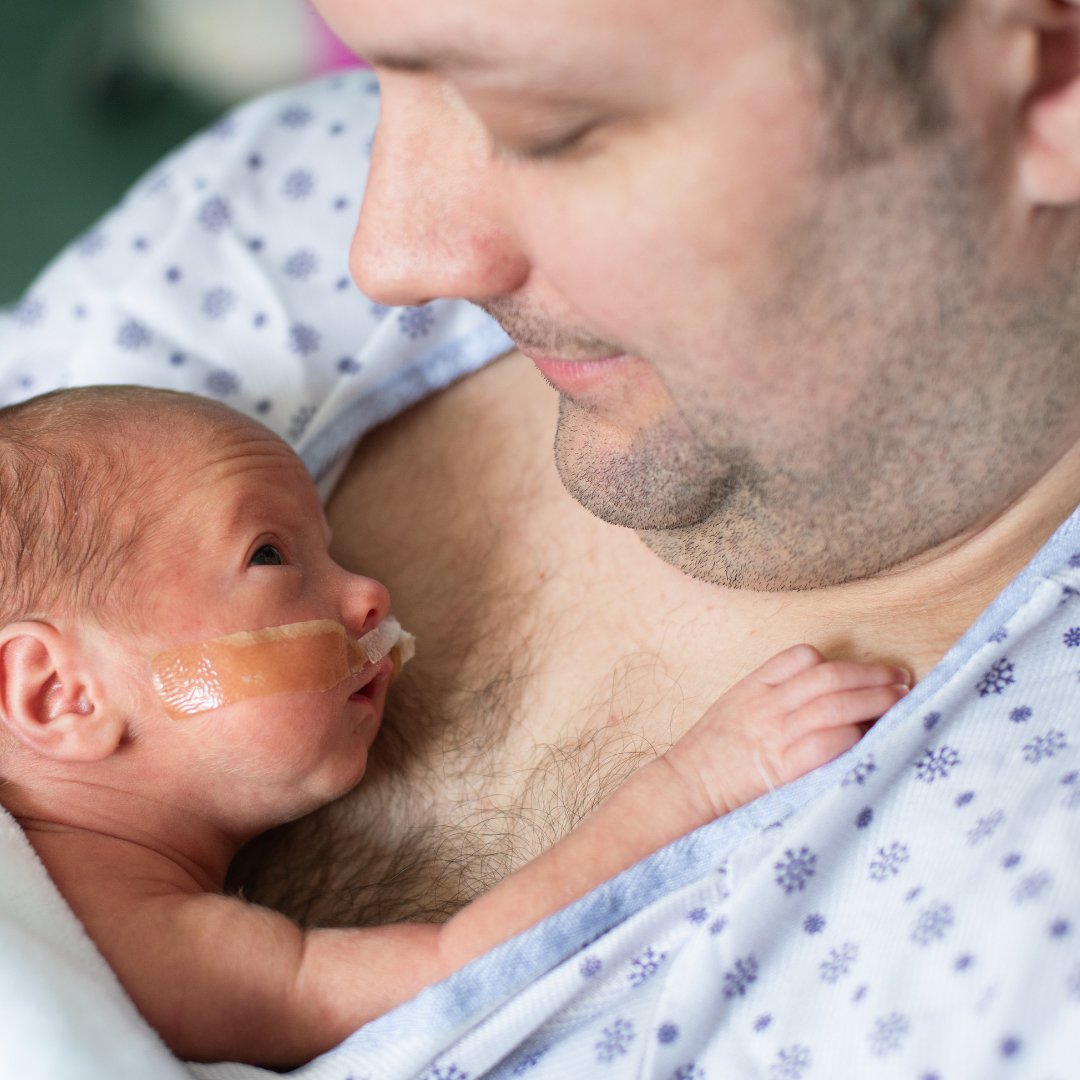 Skin to skin is the ultimate sensory experience in neonatal care.  There is no better place to sleep and grow a brain, than in the loving arms of your parents.
Quiet moments of meeting like this, is really what life is all about.