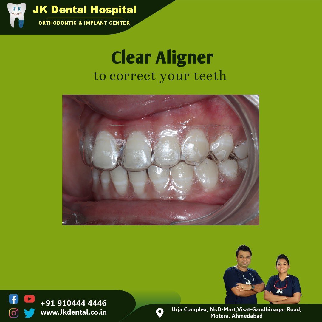 JKDENTALORTHO's tweet image. Do you have gaps in between your teeth?
Do you feel your smile is not good?
Clear Aligner can solve your problem by correcting your teeth and making your smile beautiful.
#trending #dentist #orthodontist #clearaligner #invisalign #bestdentistinchandkheda