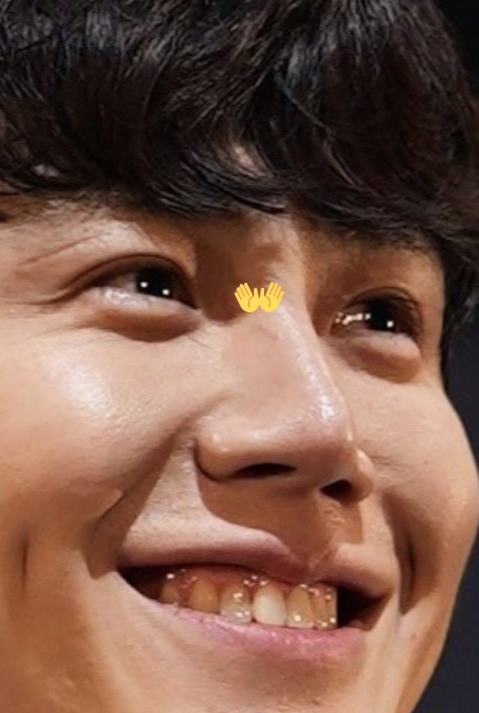 Seon_Dimples's tweet photo. The wound that was previously covered in plaster and now still has a scar 🥺 https://t.co/ZGYldoexpF