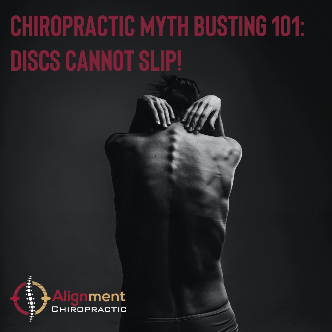 AlignmentChiro's tweet photo. Chiropractic Myth Busting: Discs cannot slip as commonly thought because each disc is attached to the vertebra above and below it. However, trauma or injury can cause discs to bulge, herniate, or rupture.
#alignmentchiropractic #chiropractor #alignment https://t.co/juAjIIq1H2