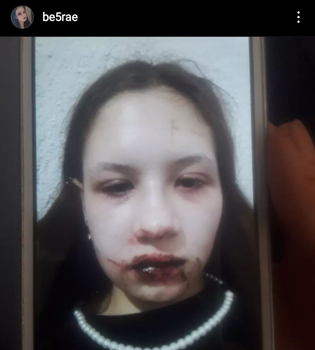 senaaysenurturk's tweet photo. Merhaba en yakın arkadaşım adına yaptığım bir paylaşım,17 yaşında genç bir kızın böylesine şiddet görmesine susmayın lütfen,Lütfen destek olun https://t.co/M5NHLzBVDE