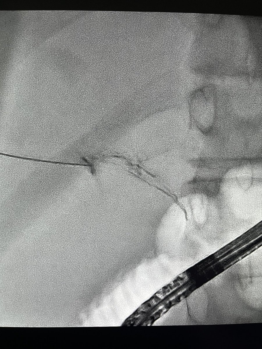 Ralph Gnannt tweet media