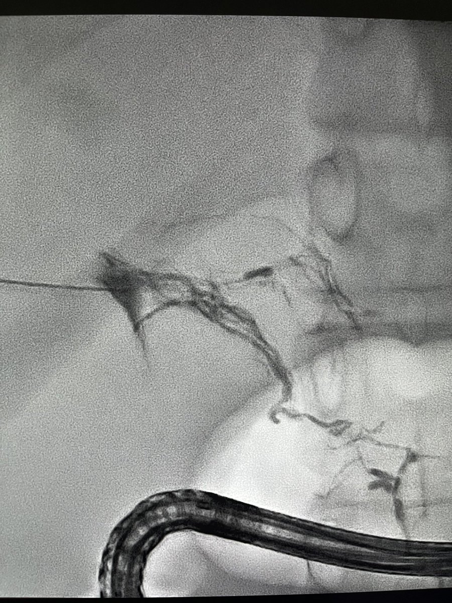 Ralph Gnannt tweet media