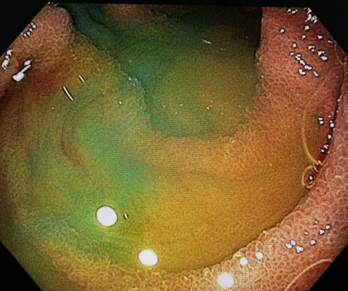 Ralph Gnannt tweet media