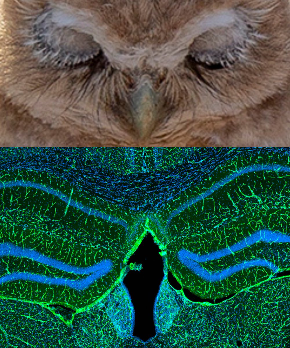 #FluorescentFriday ⁦@MontagneLab⁩ went owl out on this staining 😉Happy fluorescent Friday!