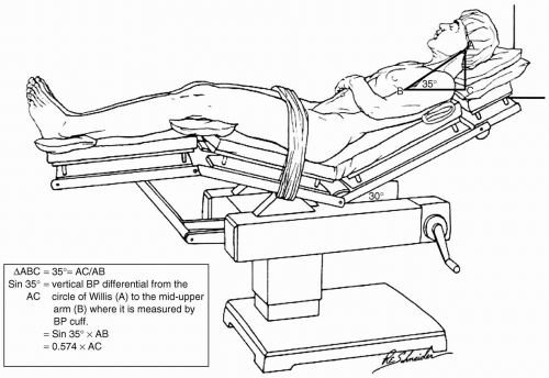 Mo Imam (@moaimam) on Twitter photo If you use the beach-chair position, either as a #surgeon or #anaesthetist, please fill in this quick (<3 min)<a href="/bessconference/">British Elbow & Shoulder Society</a> <a href="/bessconference/">British Elbow & Shoulder Society</a> and #RAUK-led survey. Your answers will help us draft national guidelines for the BeachChair position.
Link: survey.alchemer.com/s3/6904290/Tes… If you use the beach-chair position, either as a #surgeon or #anaesthetist, please fill in this quick (<3 min)<a href="/bessconference/">British Elbow & Shoulder Society</a> <a href="/bessconference/">British Elbow & Shoulder Society</a> and #RAUK-led survey. Your answers will help us draft national guidelines for the BeachChair position.
Link: survey.alchemer.com/s3/6904290/Tes…