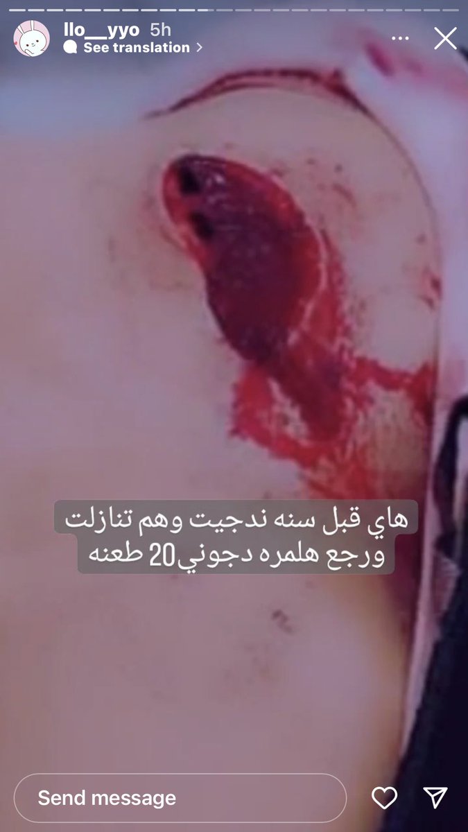 Beverly94411361's tweet photo. وحشية وهمجية بحق هذه البنت (آية الموسوي) والمهددة بالقتل من قبل أهلها.. 
 شوفوا كمية التعذيب والضرب 
  وبهاي الايام أيام مصيبة وظلم الامام الحسين (ع)
 خلي نساعدها ونوگف وياها وان شاء يوصل صوتها للجهات المسؤلة  🙏🏼
ونخلي حد لهذول الهمج والوحوش 
#أنقذوا_آية_الموسوي https://t.co/pdvFTNNKc2
