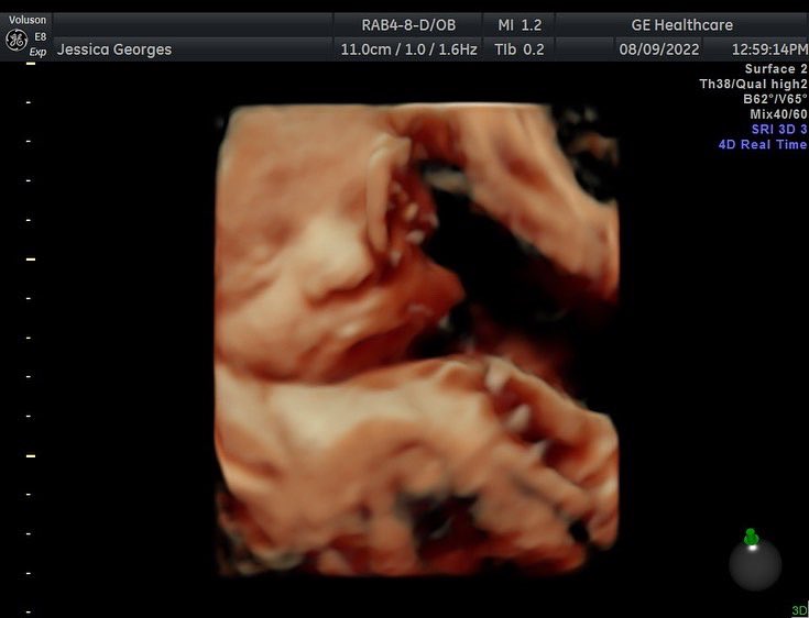 teezykage's tweet photo. 65 days until my son is here!!!❤️❤️ here’s our registry if anyone wants to get some cool stuff for the boy🫡 https://t.co/yMtpIS09Cw https://t.co/uXqpG7vC0A
