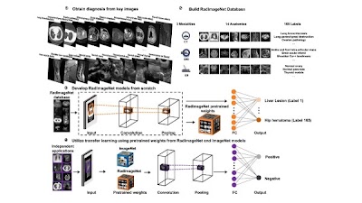 Radiology images for radiology #AI models -- improving transfer learning doi.org/10.1148/ryai.2… <a href="/twdeyer/">twdeyer</a> <a href="/yourRadiologist/">East River Imaging</a> <a href="/zahifayad/">zahifayad</a> #TransferLearning #ML #MachineLearning